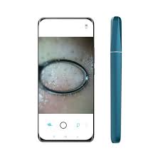 جهاز تنظيف البثور وحب الشباب الذكي wisdom Visual pore cleaner